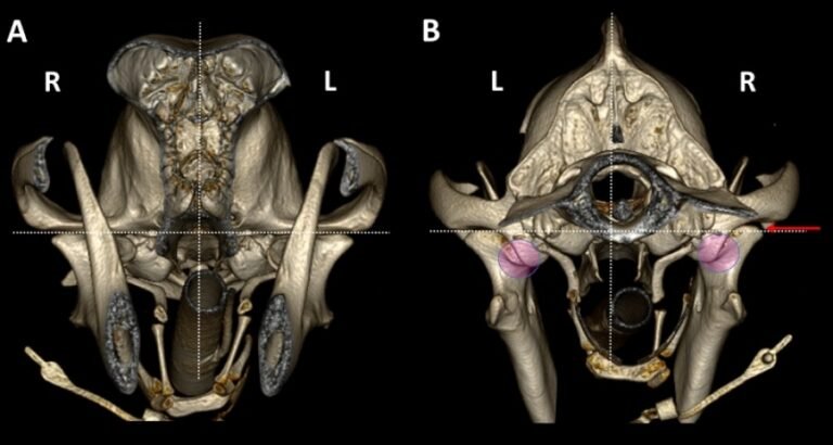 articulacion temporomandibular en detalle