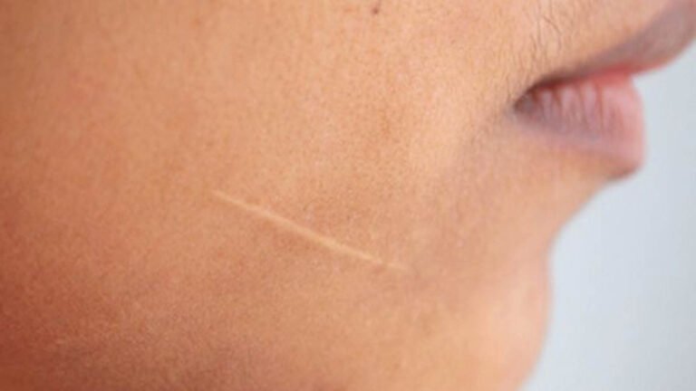 cuidado de piel con cicatrices suaves