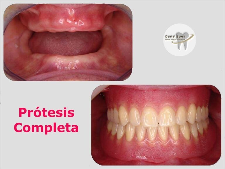 dentadura postiza brillante y limpia