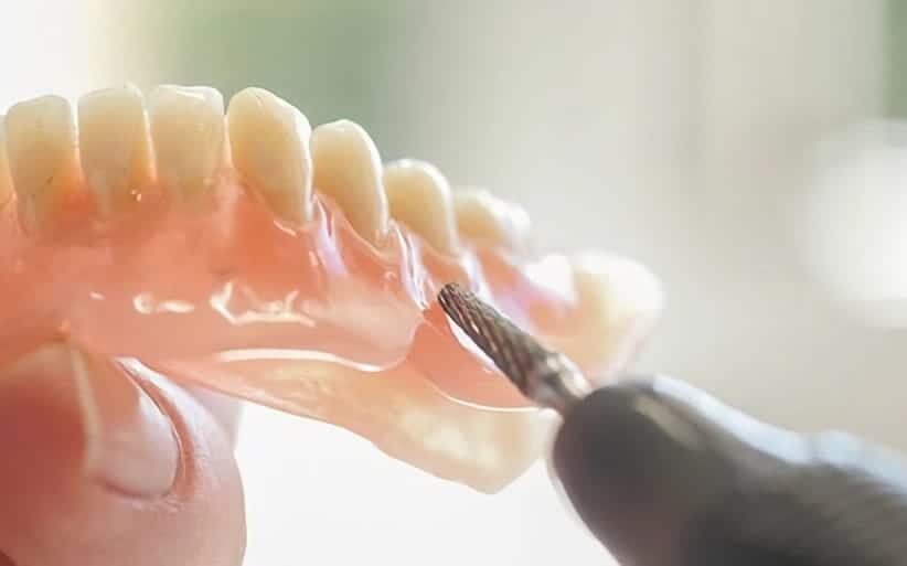 Cuánto cuesta una dentadura postiza de quita y pon en Argentina 4 Cuánto cuesta una dentadura postiza de quita y pon en Argentina