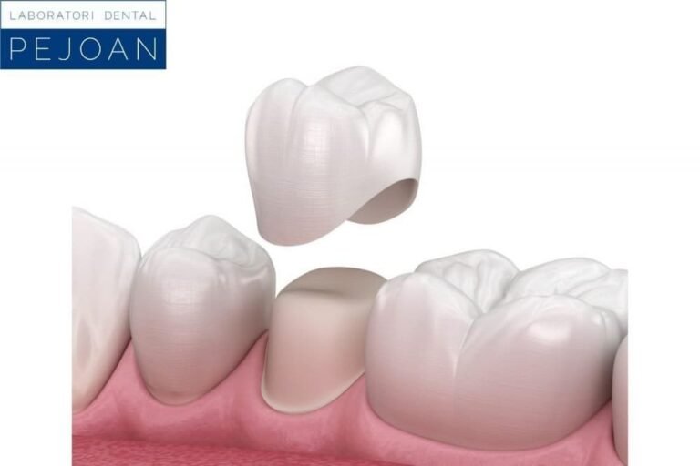 funda dental sobre fondo blanco