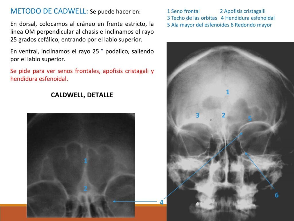 Qué información revela una radiografía de cráneo frontal 5 Qué información revela una radiografía de cráneo frontal