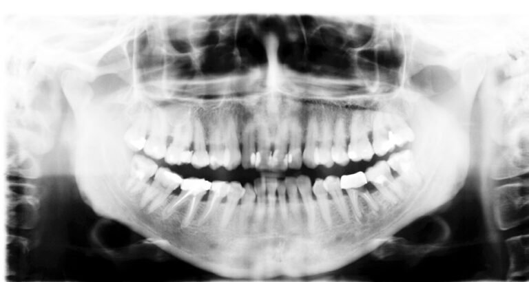 radiografia dental de un paciente